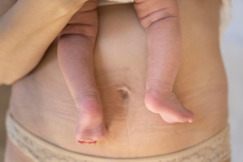 6 week postpartum visit c-section