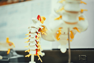 Postural Orthostatic Tachycardia Syndrome Medical Devices