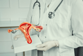 Stages of Endometriosis: a guide