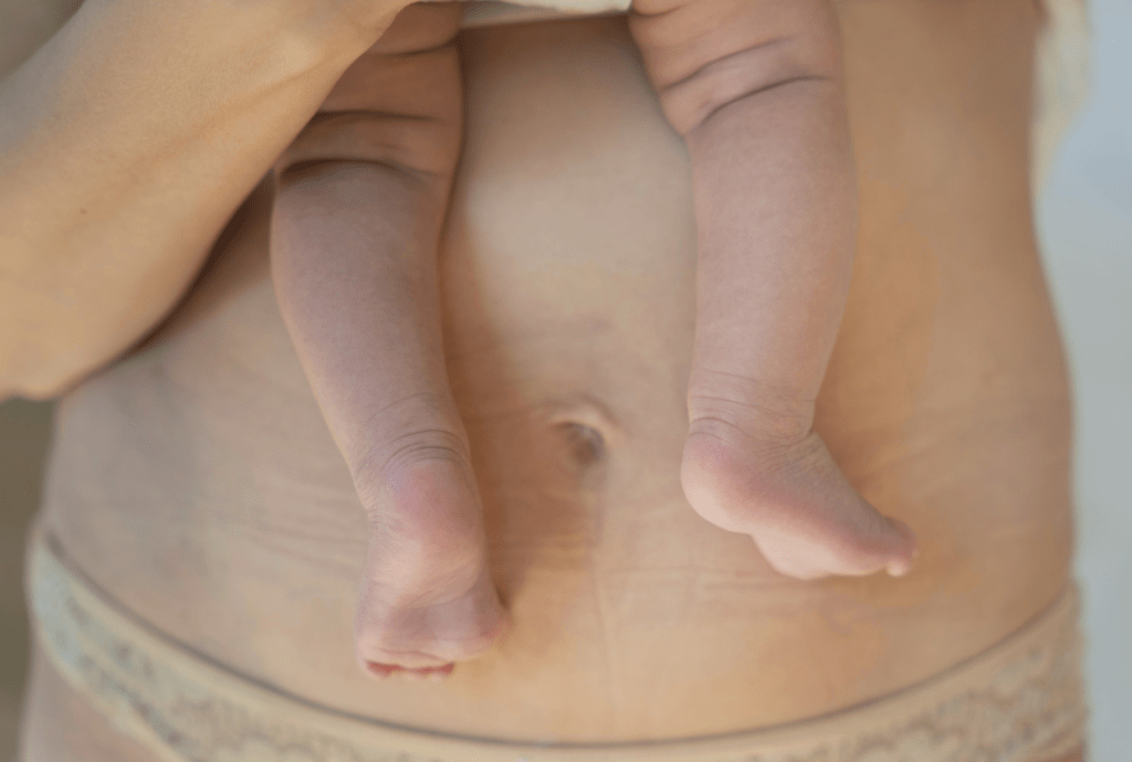 Why Is My C-Section Scar Itchy Causes & Relief Tips
