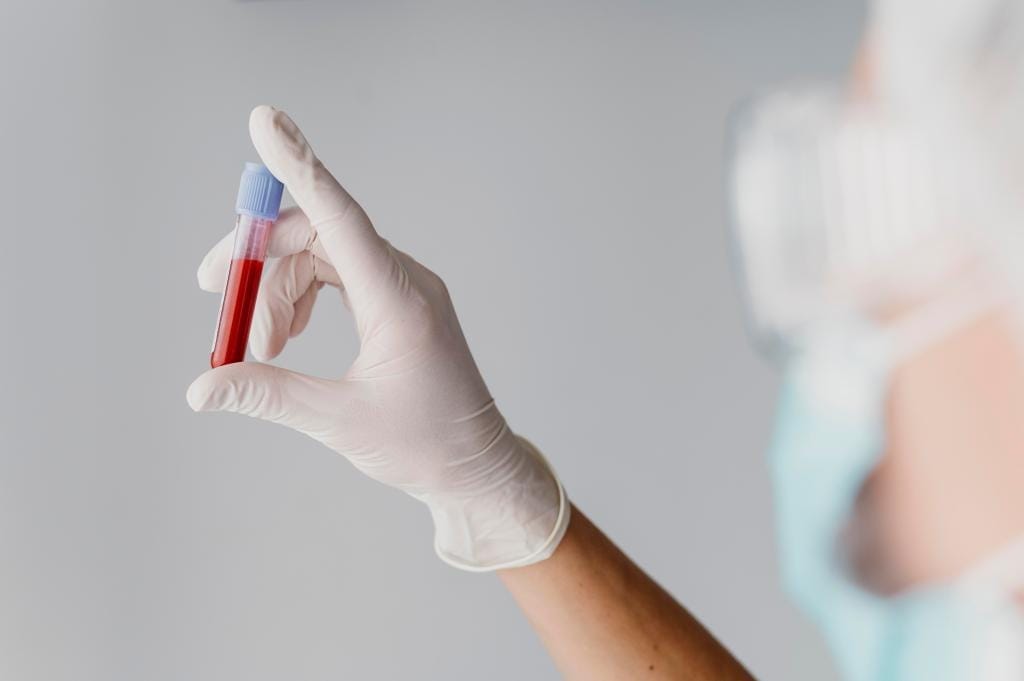 Hormontest Wann er sinnvoll ist, welche Methoden es gibt und was die Ergebnisse aussagen