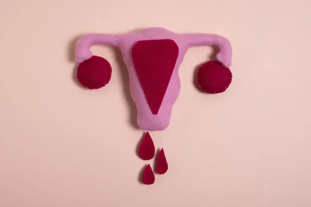 Stilisierte Darstellung der Gebärmutter mit Blutstropfen als Symbol für Menstruation und Zyklusblutung und Periode ohne Eisprung